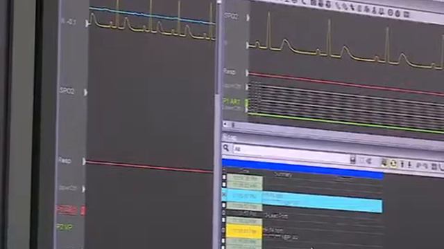 В Вологде заработал региональный сосудистый центр смотреть онлайн