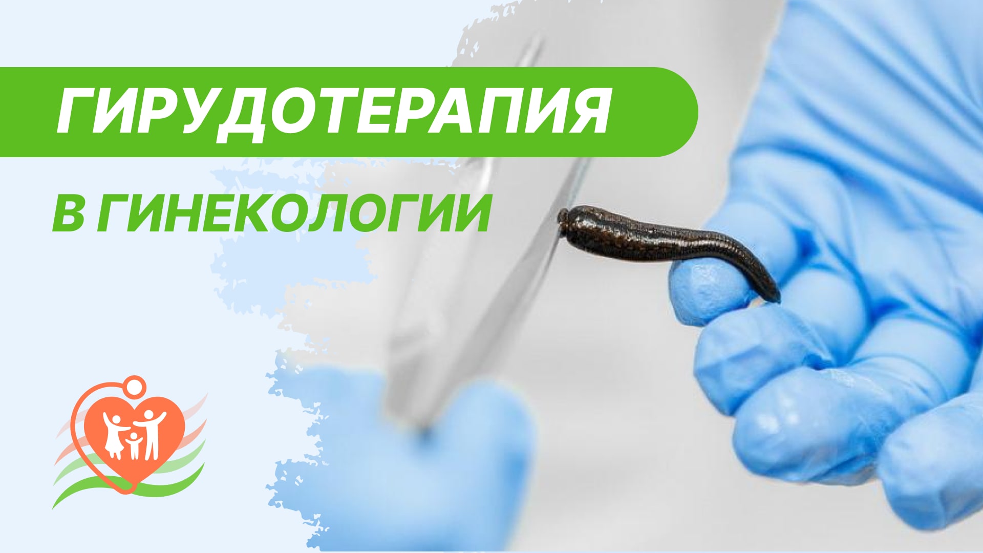 ?⚕️ Гирудотерапия в гинекологии. Пиявки