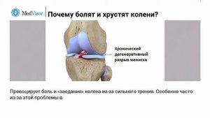 Почему болят и хрустят колени – взгляд на три типичные проблемы