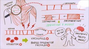 Почему болят мышцы?