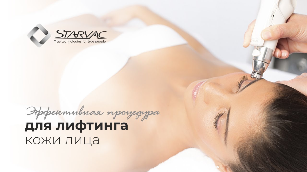 Starvac лица