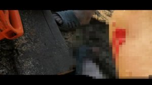 Несчастный случай/наступил на два гвоздя.