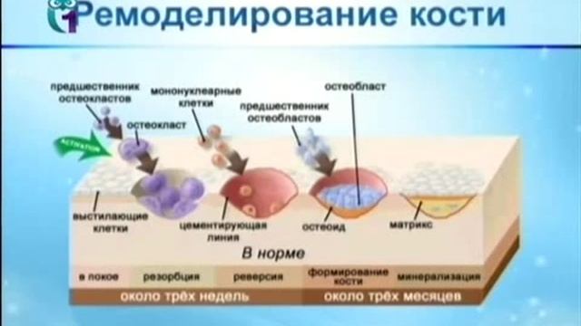 Объять необъятное. Кости (07.04.2012) смотреть онлайн