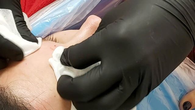 АирисКом студенты учатся: обучение ботокс. Выполнения ботокса в области лба и круговой мышцы глаза.