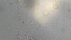 Инфузории, бактерии