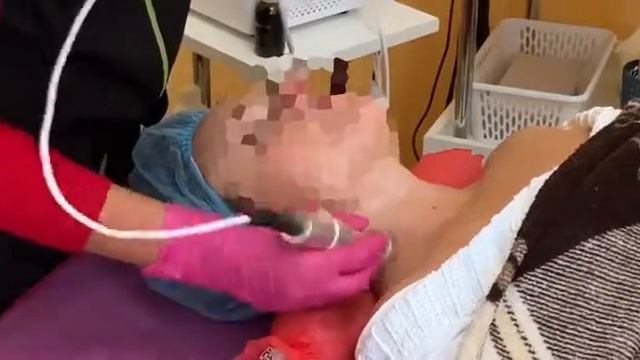 Здесь все для вашего тела. Электропорация (безинъекционная мезтерапия). Шея.