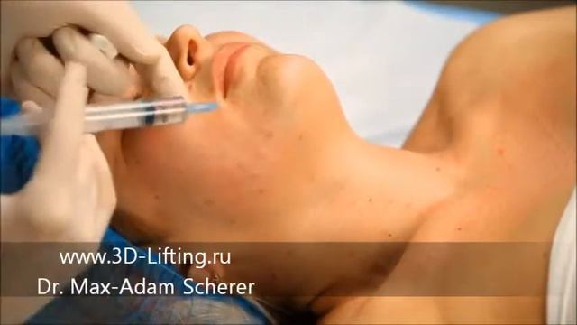 3 Макс Адам Шерер 2012 wmv смотреть онлайн