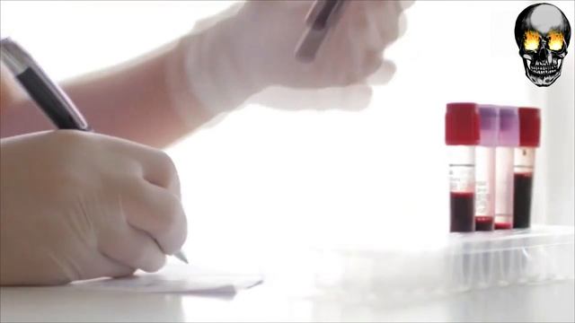 ? СВИНУШКА ТОНКАЯ | СМЕРТЕЛЬНАЯ ОПАСНОСТЬ | ПОЛНЫЙ ОБЗОР (PAXILLUS INVOLUTUS) смотреть онлайн