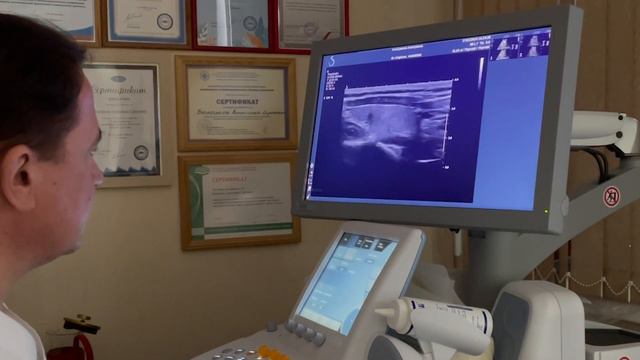 Узи для начинающих. Урок "УЗИ щитовидной железы с применением эластометрии"