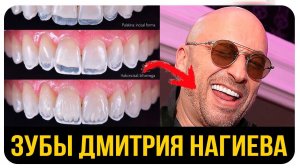 Дмитрий Нагиев. До и После. Кривые Зубы Знаменитостей. Сколько Стоят Элайнеры или Виниры?