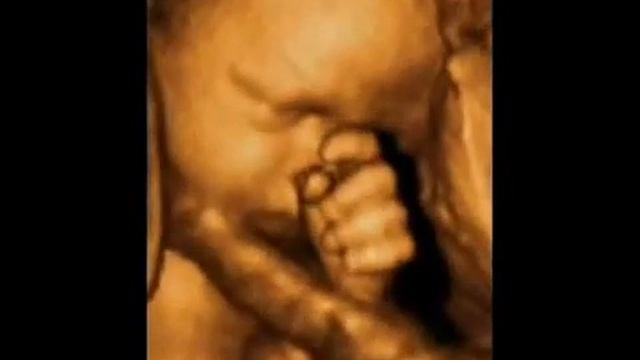 Малыш чешет нос, 31 неделя беременности, 3D УЗИ © The fetus scratches the nose