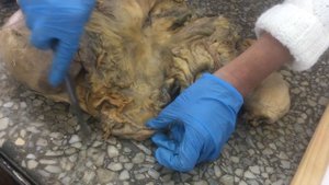 Брюшина. Топография брюшины среднего и нижнего этажа.