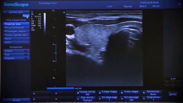 S2N 07 Измерения расчеты смотреть онлайн