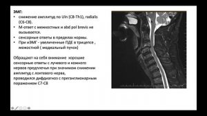 Плексопатия шейного и поясничного сплетений. Фокус на миографические исследования. Виртуальный ЖК.