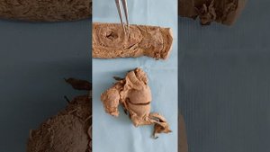 Женские половые органы. Промежность