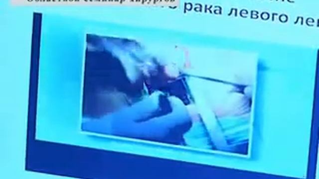 "Проведение областного семинара хирургов в Семейской жд больнице" 20.06.2012г. смотреть онлайн