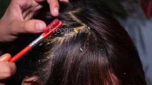 Huge Flakes! Itchy Scalp Using Hair Comb, Scratching My Head # 134