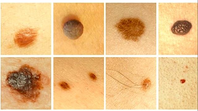 нужны ли родинки смотреть онлайн