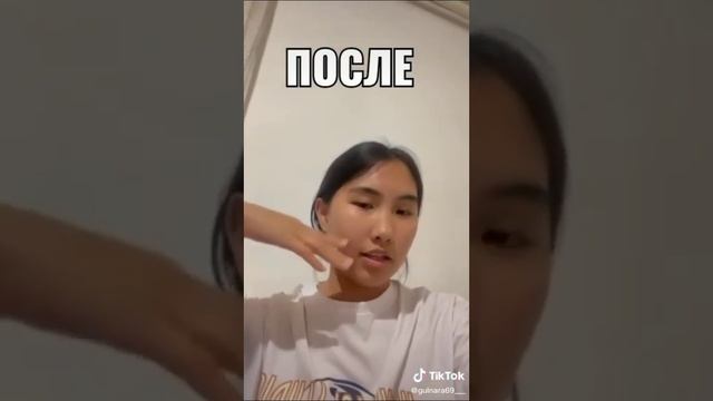 Безеу кетіру жолдары. Прыщи.