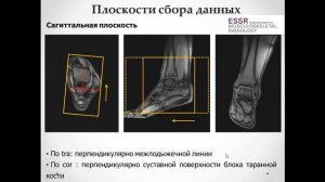 Базовый курс МРТ «МР анатомия голеностопного сустава и методика сбора данных» Лектор Учеваткин А.А