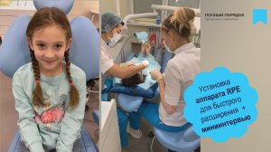 Установка аппарата RPE для быстрого расширения + миниинтервью с юной пациенткой после приема