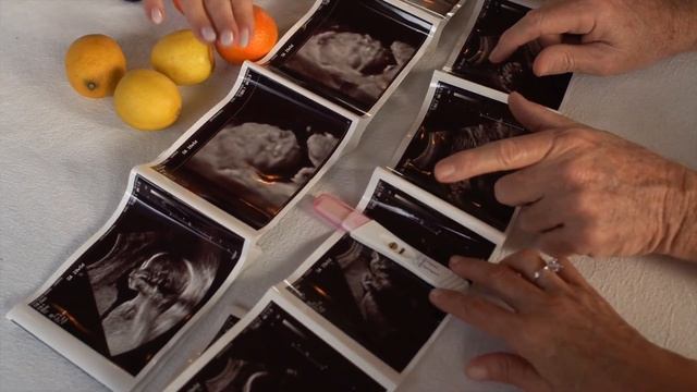 КАК ВЫБРАТЬ ПОЛ РЕБЕНКА | Как запланировать пол ребенка