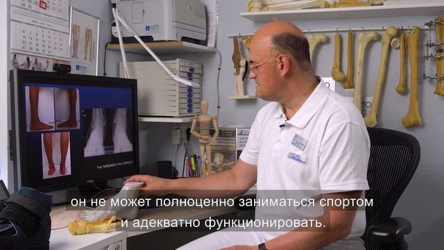 Лечение стопы