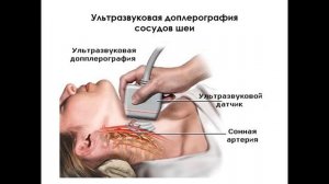 Лекция. Острые НМК. Сосудистые КР.