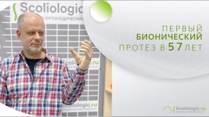 Первый бионический протез в 57 лет
