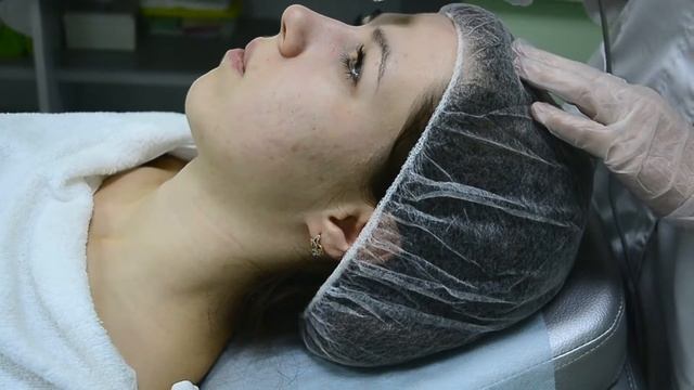 Чистка лица смотреть онлайн