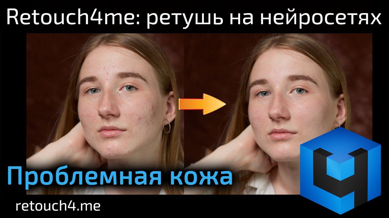 Retouch4me Heal: ретушь на нейросетях. Проблемная кожа смотреть онлайн