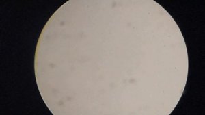 ЛАЗЕРНЫЙ наручный прибор улучшил мою кровь