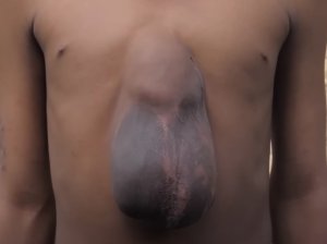 Сердце не там где надо