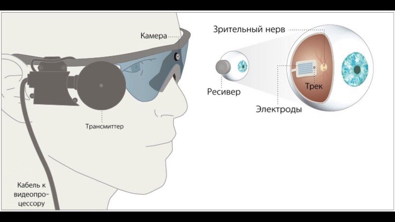 Вернуть зрение: в России установили ретинальные импланты слепоглухому пациенту
