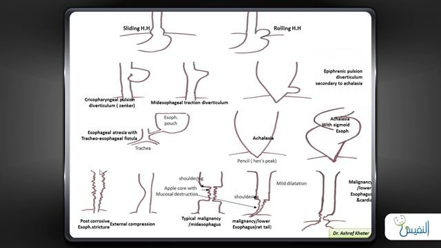 Git Radiology (1) - Surgery смотреть онлайн