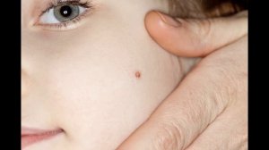 Признаки рака на ранней стадии у детей