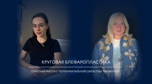 Круговая блефаропластика: осмотр через два месяца