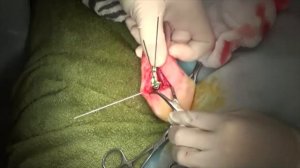 TPLO с медиализацией плато у карликовых пород собак