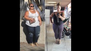 Делать или не делать бариатрическую операцию, вот в чем вопрос.