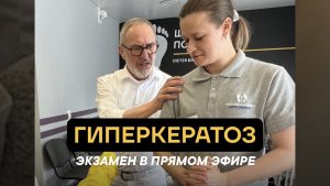 Гиперкератоз