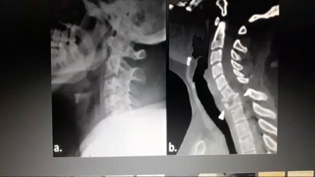 Почему Люди Рождаются Левшами? смотреть онлайн