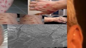 ПАРАЗИТЫ В ОРГАНИЗМЕ ЧЕЛОВЕКА