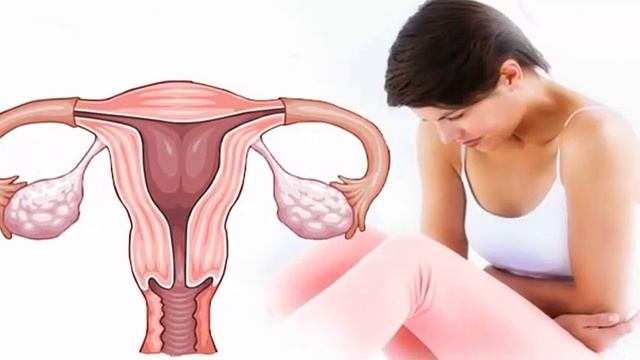 ПЬЮ И ОЖИВАЮ! РАСТВОРЯЕТ БЛЯШКИ Тромбов НЕТ! Чудо Чай От 100 Недугов! Разглаживает морщины смотреть онлайн