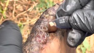 Moses's heavily jiggered right foot (part B) - FULL VIDEO, subscribe to www.riseupsociety.net