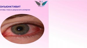 Заболевания глаз - мастерам наращивания, ламинирование ресниц и татуажа