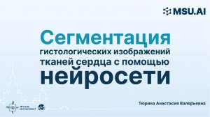 Сегментация гистологических изображений тканей сердца с помощью нейросети