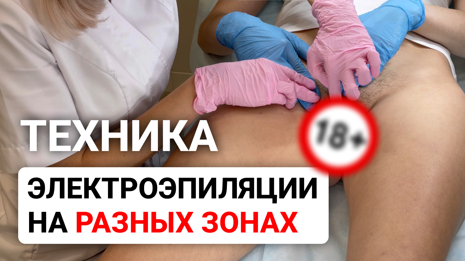 Урок №44. Электроэпиляция на разных зонах - техника электроэпиляции без боли