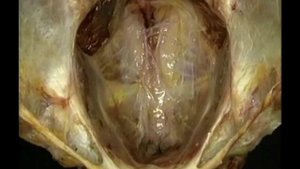 Анатомия Акланда. ТОМ 3. Мышечно-скелетная система туловища.  Часть 4. Таз.