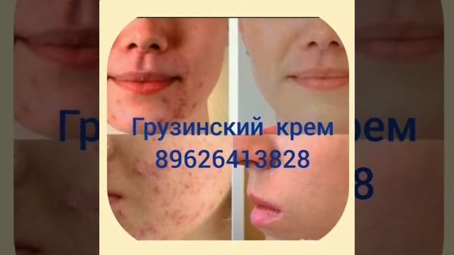 крем виши от пигментации смотреть онлайн