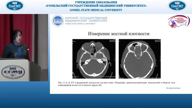 Республиканская научно-практическая конференция «Лучевая диагностика в клинической практике» смотреть онлайн